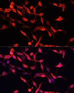 ENO3 Antibody in Immunocytochemistry (ICC/IF)