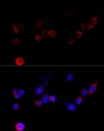 Filamin A Polyclonal Antibody
