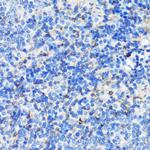 Filamin A Antibody in Immunohistochemistry (Paraffin) (IHC (P))