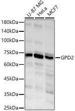 GPD2 Polyclonal Antibody
