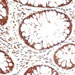 Cytokeratin 13 Antibody in Immunohistochemistry (Paraffin) (IHC (P))