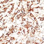 Cytokeratin 13 Polyclonal Antibody