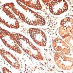 Cytokeratin 13 Antibody in Immunohistochemistry (Paraffin) (IHC (P))