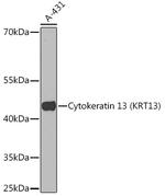 Cytokeratin 13 Antibody in Western Blot (WB)