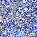 CAND2 Antibody in Immunohistochemistry (Paraffin) (IHC (P))