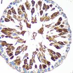 CAND2 Antibody in Immunohistochemistry (Paraffin) (IHC (P))