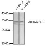 ARHGAP11B Antibody in Western Blot (WB)