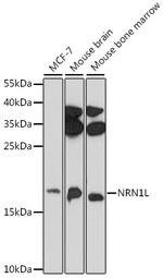 NRN1L Polyclonal Antibody