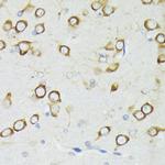 PDPK1 Polyclonal Antibody