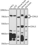NKIAMRE Antibody in Western Blot (WB)