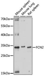 L-Ficolin Polyclonal Antibody