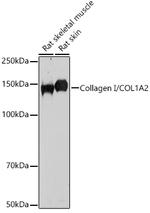 COL1A2 Polyclonal Antibody