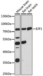 E2F1 Polyclonal Antibody