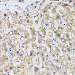 AMOTL2 Polyclonal Antibody