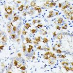 AMOTL2 Antibody in Immunohistochemistry (Paraffin) (IHC (P))