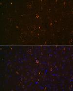 ABCA2 Antibody in Immunohistochemistry (Paraffin) (IHC (P))