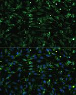 CHRM1 Antibody in Immunocytochemistry (ICC/IF)