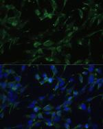 CHRM1 Antibody in Immunocytochemistry (ICC/IF)