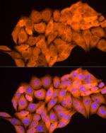 AKR1B1 Antibody in Immunocytochemistry (ICC/IF)