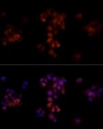 AKR1B1 Antibody in Immunocytochemistry (ICC/IF)