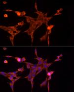 AKR1B1 Polyclonal Antibody