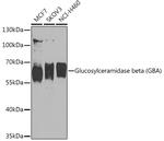 GBA Polyclonal Antibody