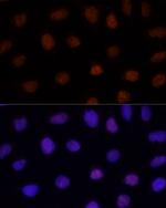 GLI2 Antibody in Immunocytochemistry (ICC/IF)