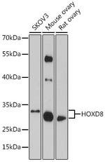 HOXD8 Polyclonal Antibody