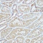 TOMM20 Antibody in Immunohistochemistry (Paraffin) (IHC (P))