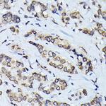 Lamin B1 Antibody in Immunohistochemistry (Paraffin) (IHC (P))