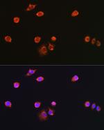 NPR3 Polyclonal Antibody