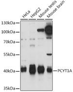 PCYT1A Polyclonal Antibody