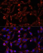 UCP3 Antibody in Immunocytochemistry (ICC/IF)