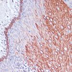 WIPF1 Polyclonal Antibody