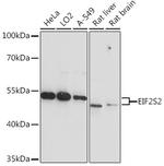 eIF2 beta Polyclonal Antibody