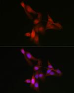 YAP1 Antibody in Immunocytochemistry (ICC/IF)