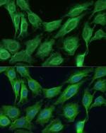 CNNM1 Antibody in Immunocytochemistry (ICC/IF)