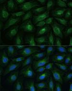 CNNM1 Polyclonal Antibody