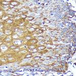 CYB5R1 Polyclonal Antibody