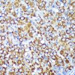 CYB5R1 Antibody in Immunohistochemistry (Paraffin) (IHC (P))