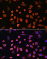 EDEM2 Polyclonal Antibody