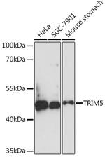 TRIM5 beta Polyclonal Antibody