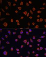 ZCCHC3 Polyclonal Antibody