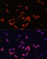 PIK3R2 Polyclonal Antibody