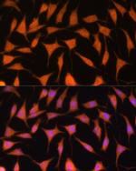 TIMM44 Antibody in Immunocytochemistry (ICC/IF)