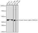CK2 alpha-1 Polyclonal Antibody