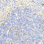 DNMT1 Antibody in Immunohistochemistry (Paraffin) (IHC (P))