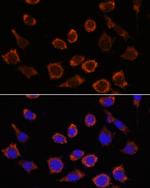 RPL35 Polyclonal Antibody