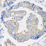 RPL35 Antibody in Immunohistochemistry (Paraffin) (IHC (P))