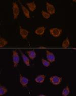 Carbonic Anhydrase VB Antibody in Immunocytochemistry (ICC/IF)